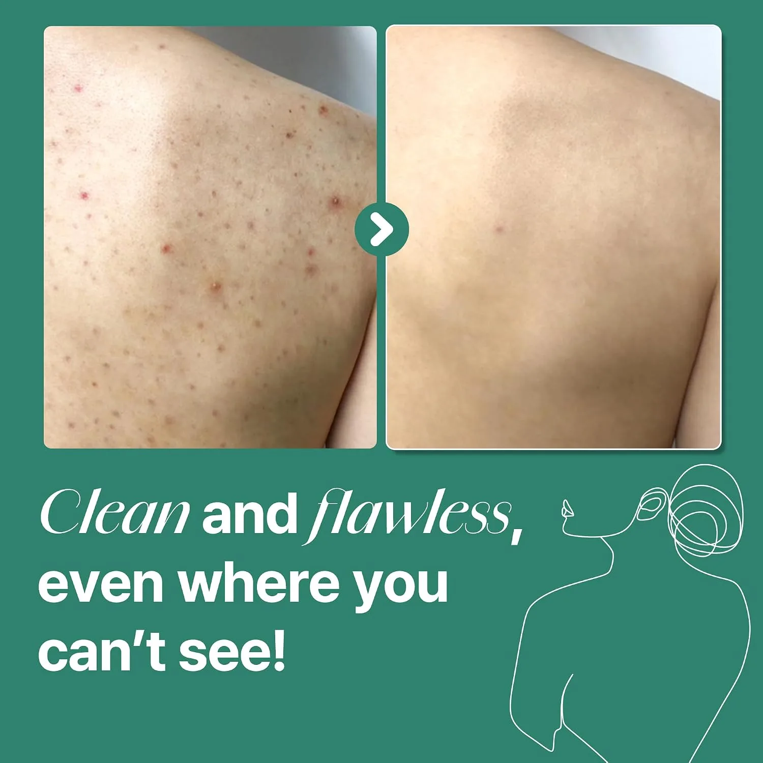 SOME BY MI AHA BHA PHA 30 Days Miracle Acne Clear Body Cleanser 400g 4