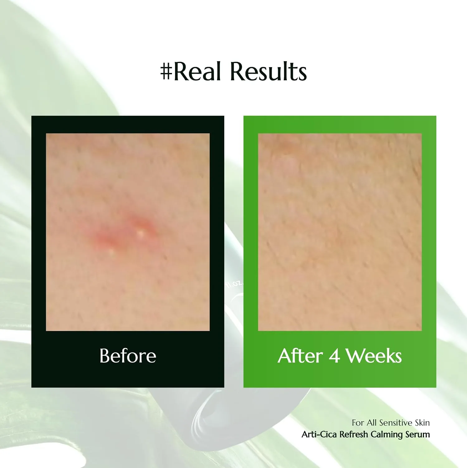 molvany Arti-Cica Refresh Calming Serum 5