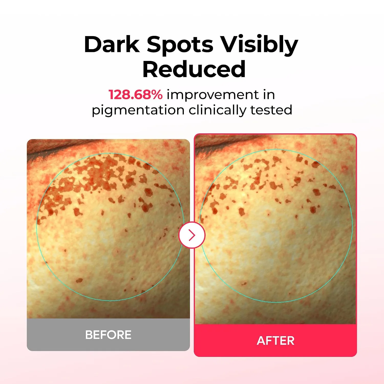 Dr.Melaxin TX-ASTAXANTHIN DARK SPOT CARE CREAM HYDEOGEL MASK 2g+34g*4ea 3