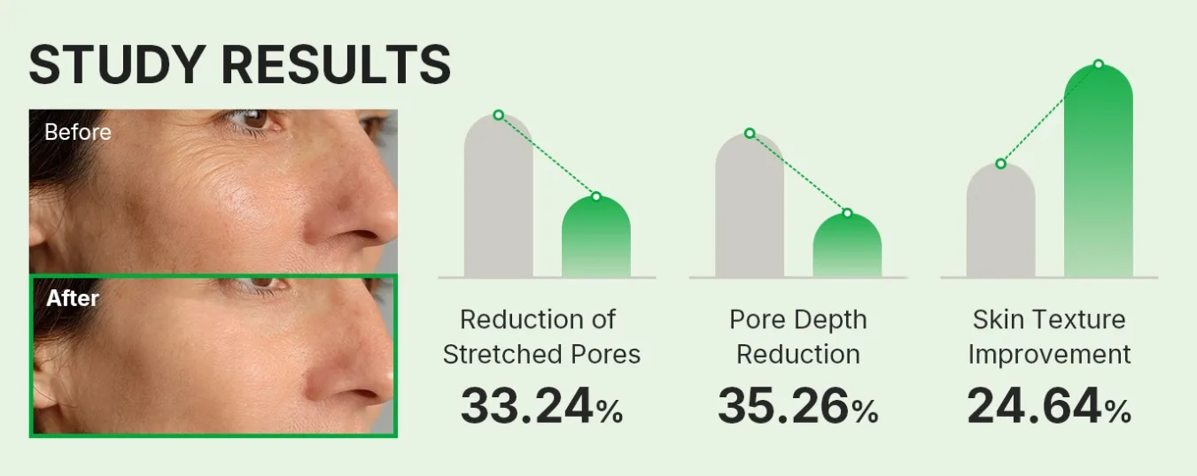 Sungboon Editor Green Tomato Spicule Pore Boosting Ampoule 30ml 7