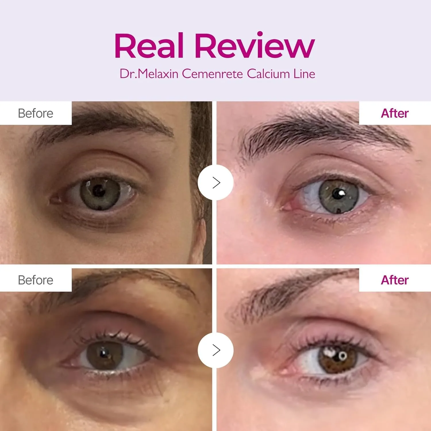 Dr.Melaxin Cemenrete Calcium Intense Cream 50ml 2