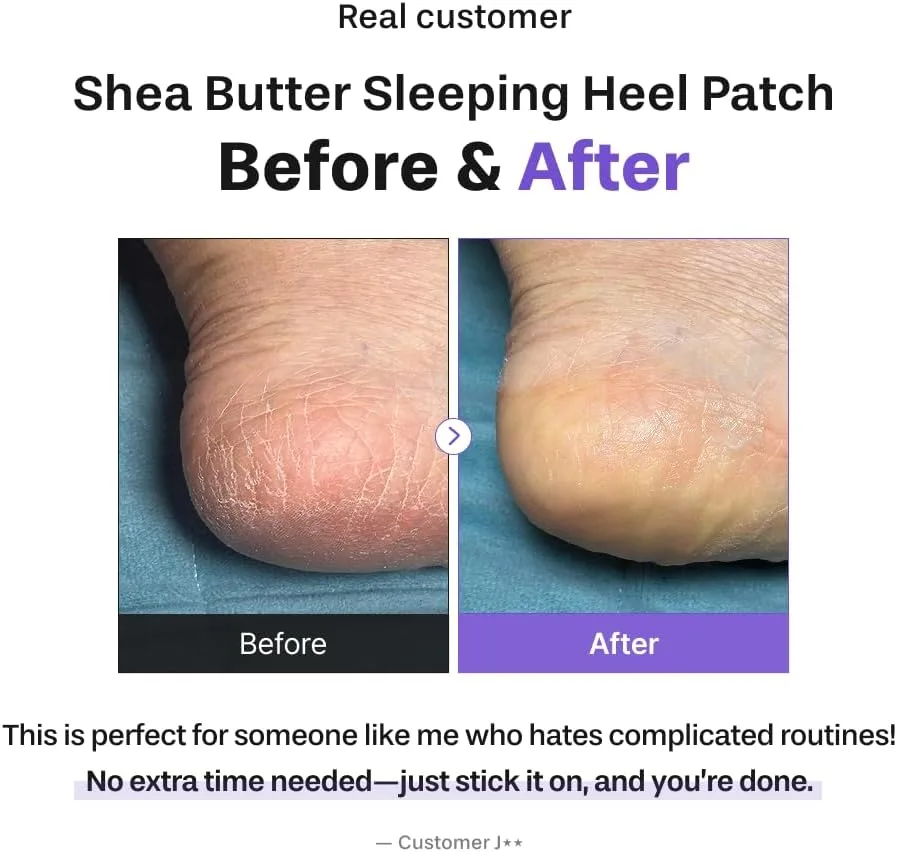 BAREN Shea Butter Sleeping Heel Patch 10ea 2