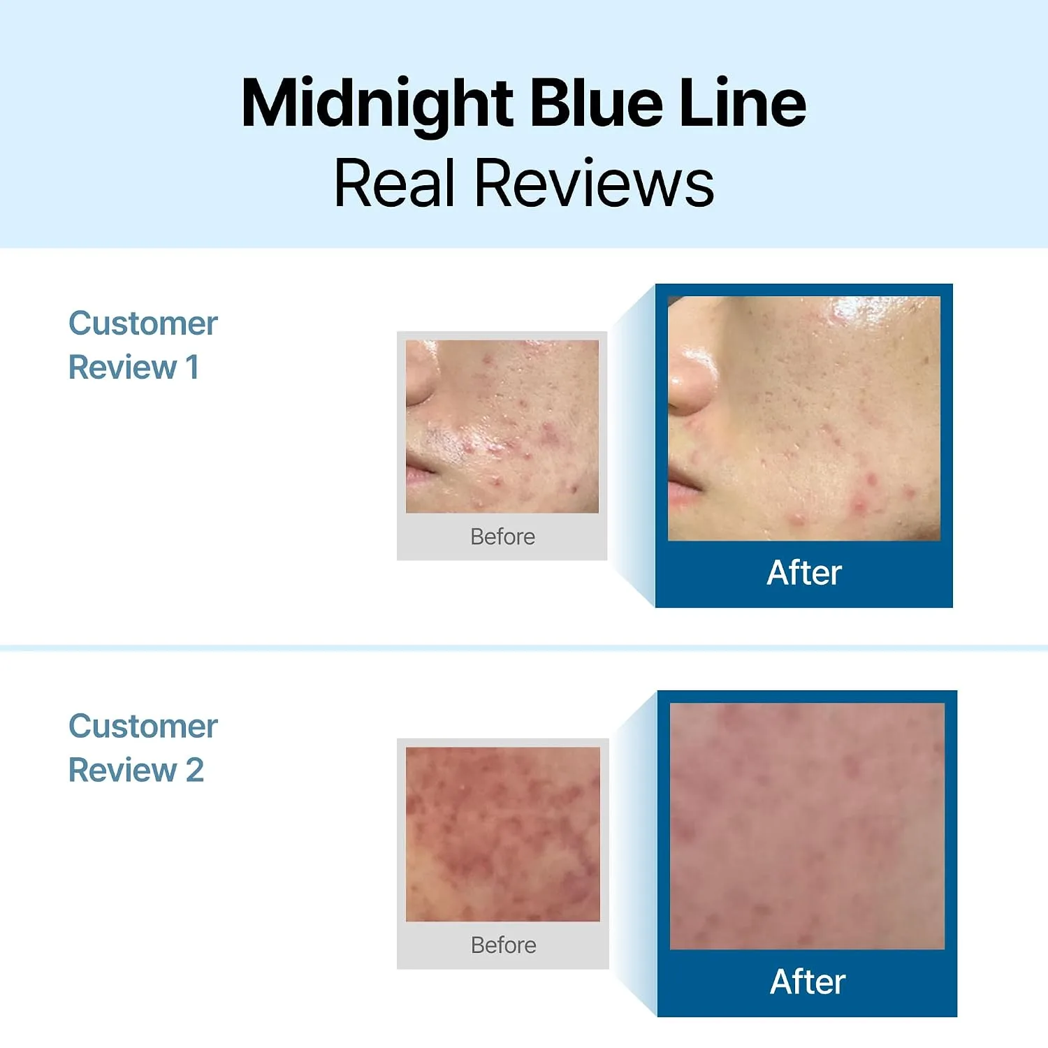 Dear, Klairs Midnight Blue Calming Cream 60g 2