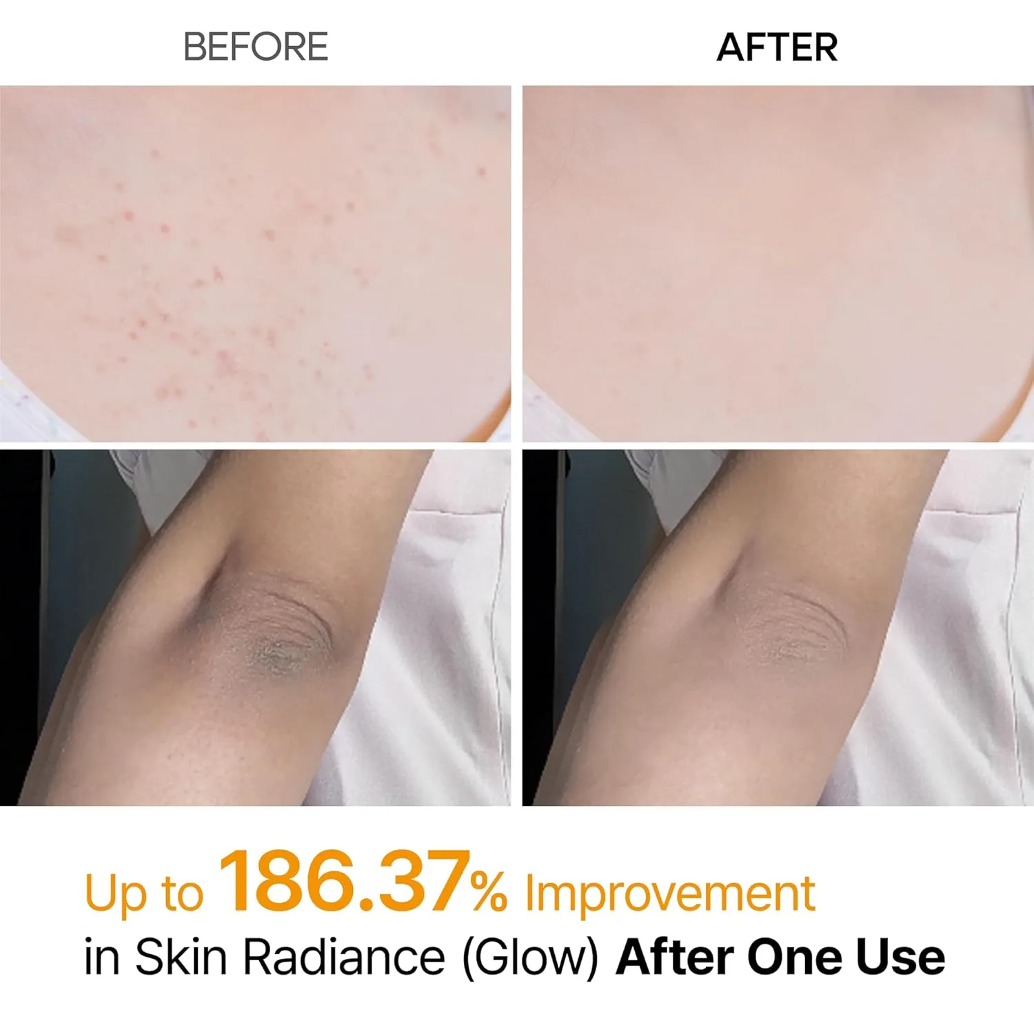 Dr.Melaxin PEEL SHOT EXFOLIATING KOJIC ACID TURMERIC SPRAY 200ml 3