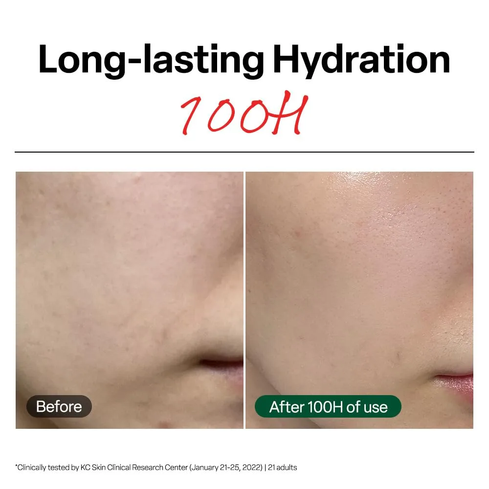 DR.G R.E.D BLEMISH CLEAR SOOTHING CREAM 70ML 3
