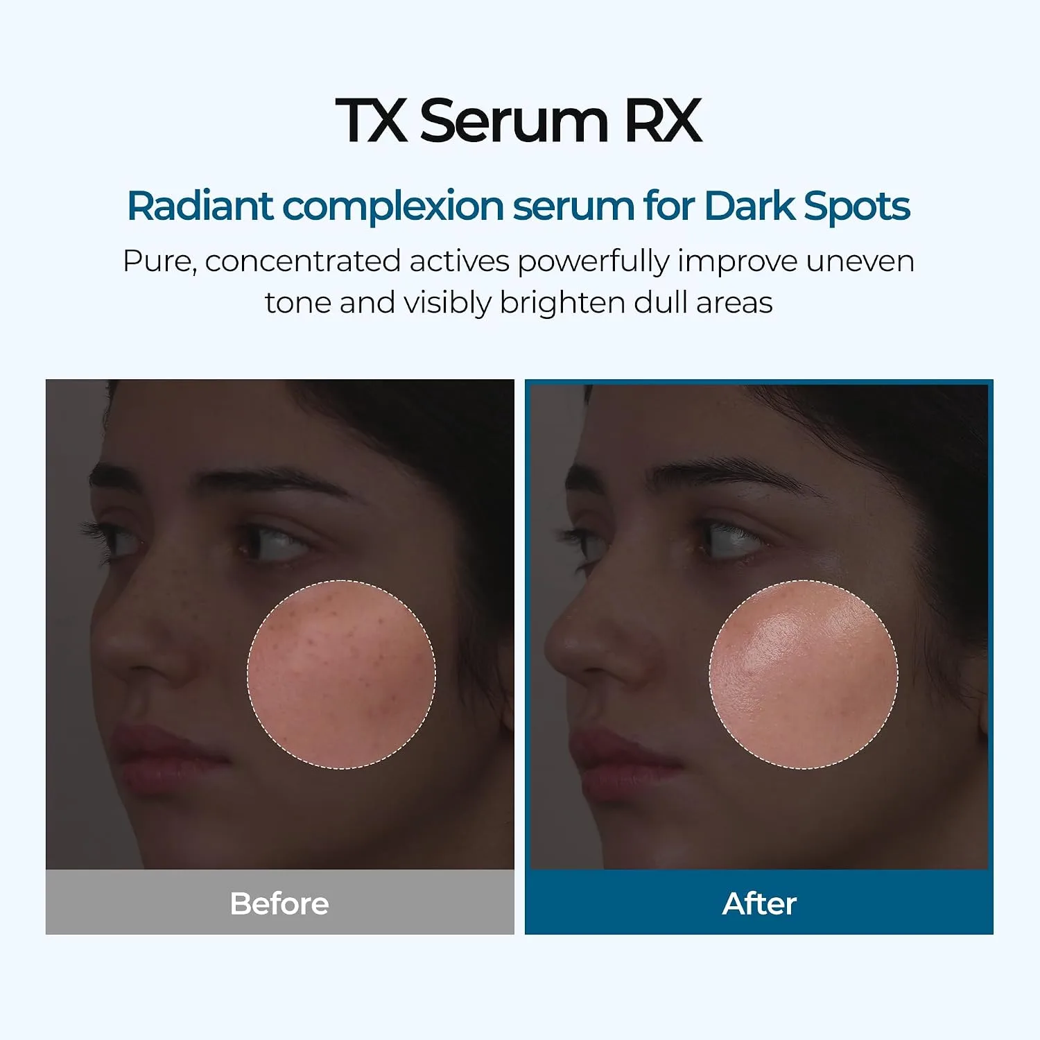 Dr.Melaxin TX Ampoule Rx 30ml 2