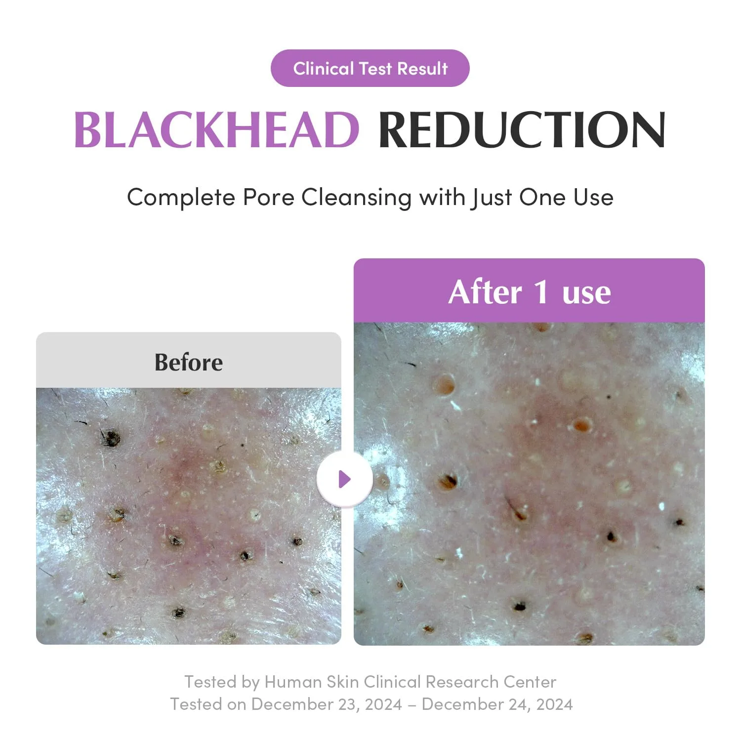 EQQUALBERRY Purple Rice Pore Purifying Pack Cleanser 130g 5