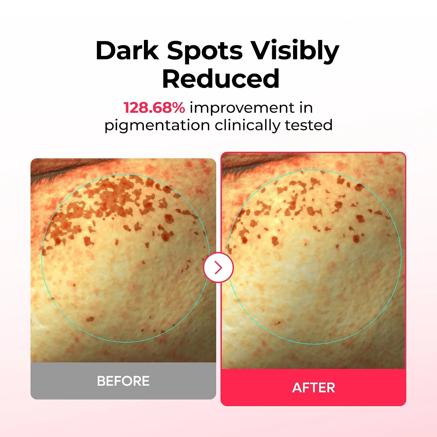 Dr.Melaxin TX-ASTAXANTHIN DARK SPOT CARE CREAM HYDEOGEL MASK 1ea 3