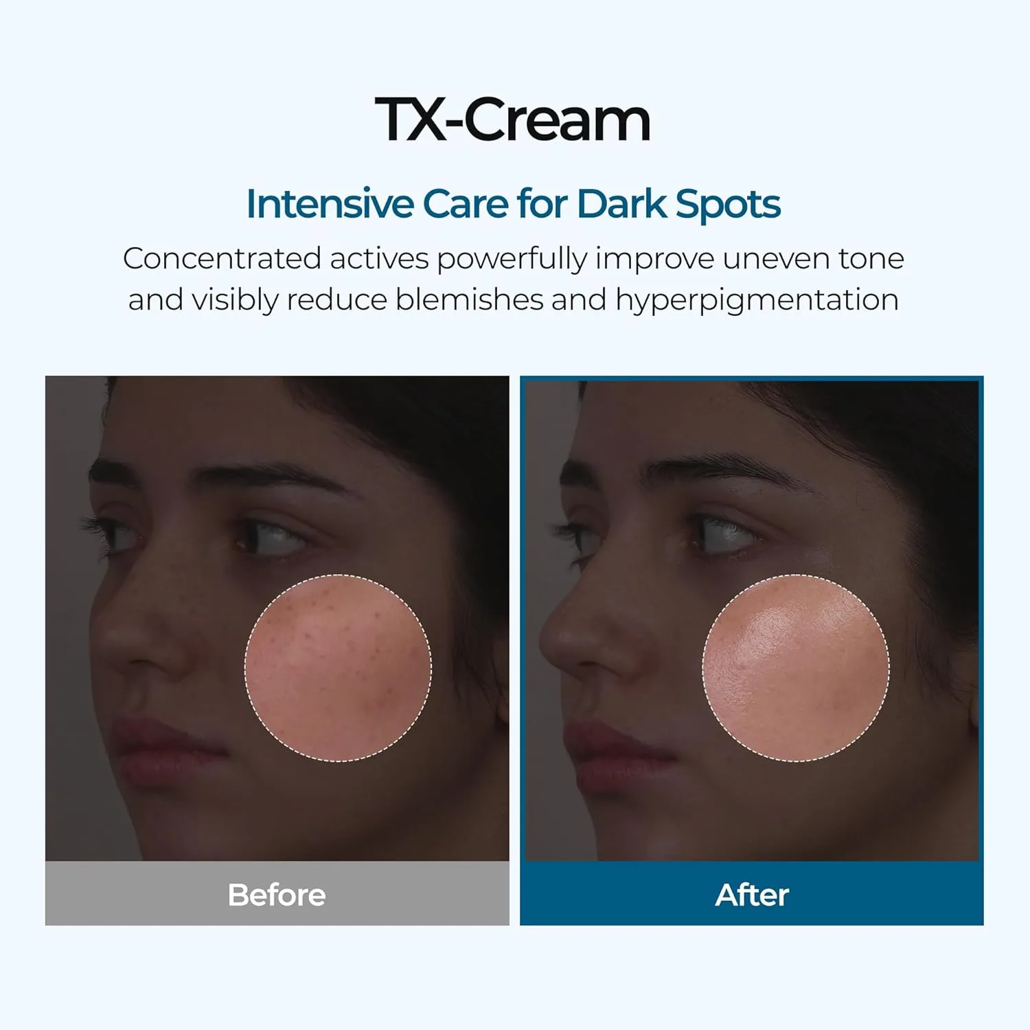 Dr.Melaxin TX Cream 50ml 2